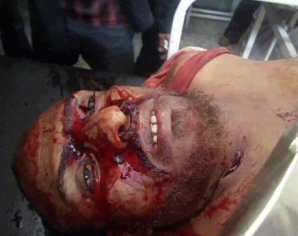 حركة شباب عدن تدين قصف الضالع وتطالب بتقديم النظام للمحاكمة الدولية