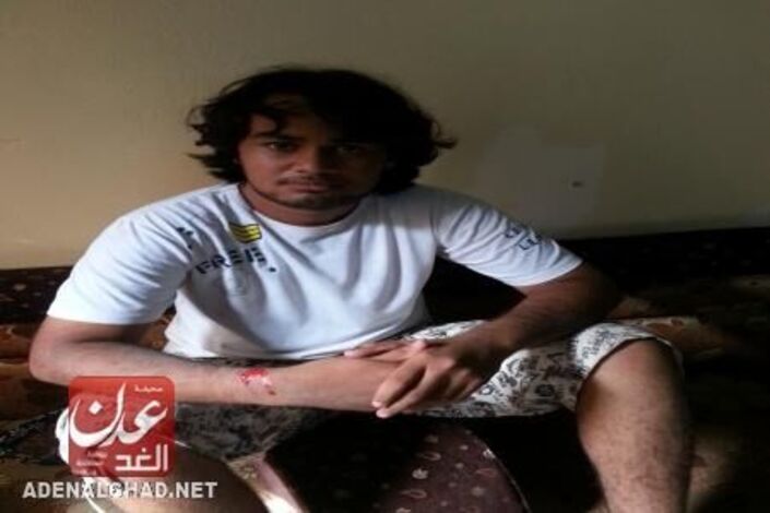 جنود من الأمن المركزي يعتدون بالضرب المبرح على مراسل (عدن الغد) بكريتر ويصيبونه بجراح