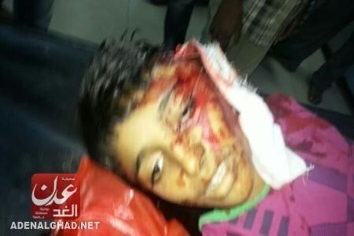 حدث قبل قليل : مقتل طفل برصاص الجيش اليمني اثر اصابته بعيار ناري في الراس بالمنصورة (مصور )
