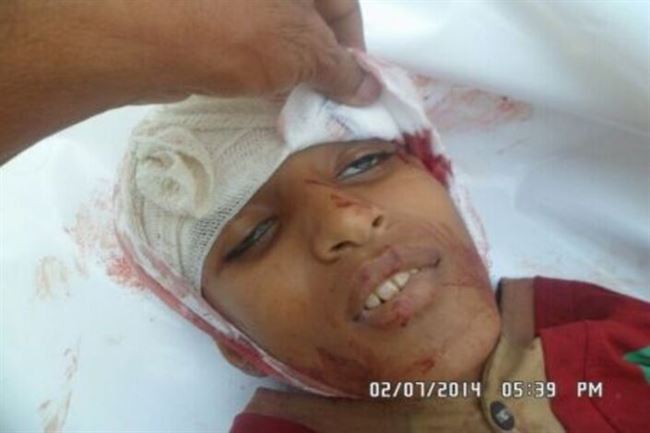 الحراك الجنوبي يدعو لمساءلة السلطات اليمنية عن جرائم قتل وحشية في الضالع