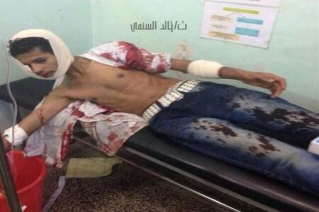 جرحى في تجدد قصف الجيش اليمني لمناطق سكنية بالضالع