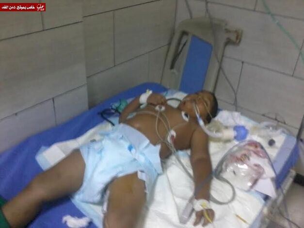 سيارة تصدم طفل شمال عدن وتصيبه بجراح بالغة وتفر (مصور)
