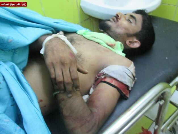 مصدر طبي : مقتل شاب متأثرا بجراح أصيب بها اثر إطلاق قوات الأمن النار على متظاهرين بعدن