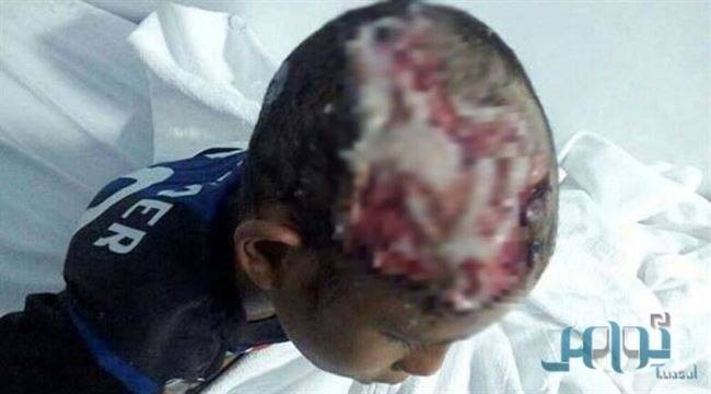 مواطنة يمنية تروي مأساتها: طليقي السعودي سلخ رأس أحد ابنائي وهدد الأخر بالقتل