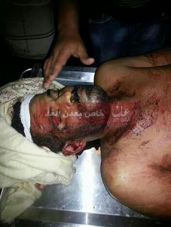 حدث قبل قليل : مقتل سائق سيارة تاكس برصاص مسلح بمنطقة بير احمد غرب عدن