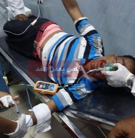 7 جرحى اثر اطلاق قوات الجيش اليمنية النار على متظاهرين بخور مكسر (مصور)