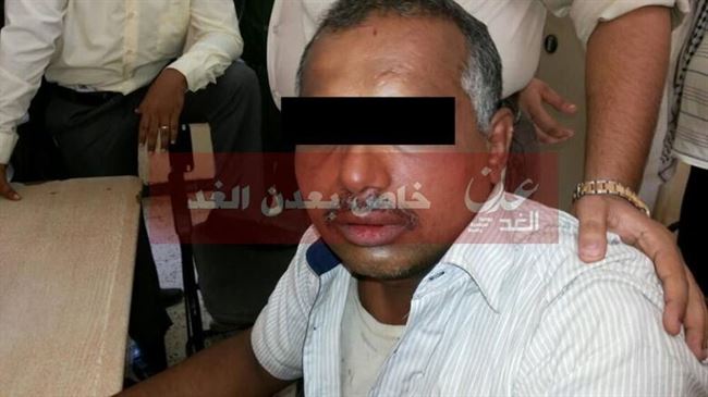 الشرطة المحلية في الشيخ عثمان تضبط متهما بقضايا جنائية (مصور)