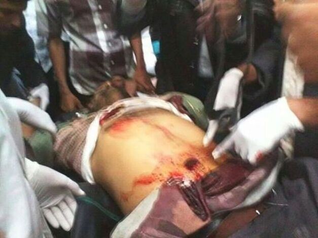 حدث قبل قليل :مقتل شخص برصاص قوات الأمن اليمنية بعتق