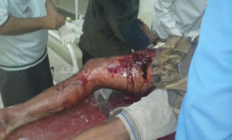 حدث قبل قليل : اصابة مواطن برصاص مسلحين مجهولين في مودية