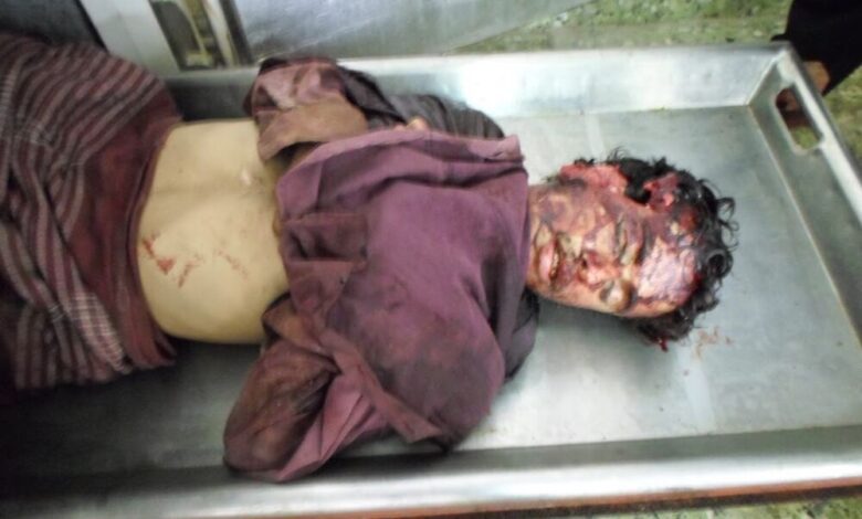وصول جثامين شهداء  الملاح سقطوا جراء قصف قوات الجيش اليمني الى مستشفى ابن خلدون بلحج((مصور))