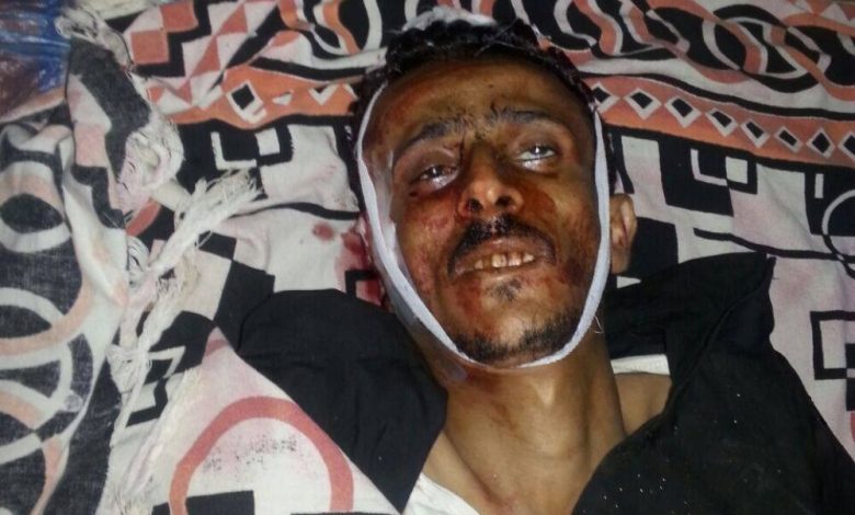 استشهاد ناشط في الحراك الجنوبي برصاص قوات موالية للحوثيين بعدن