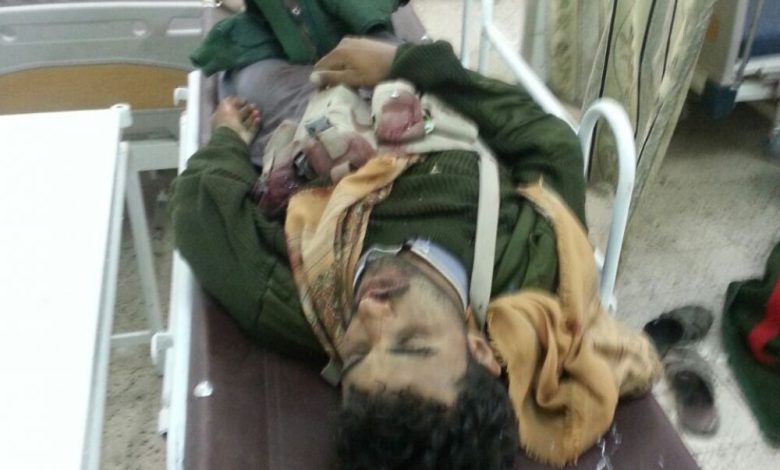 3 قتلى من القوات الموالية للحوثيين في اشتباكات مع المقاومة الجنوبية بعتق