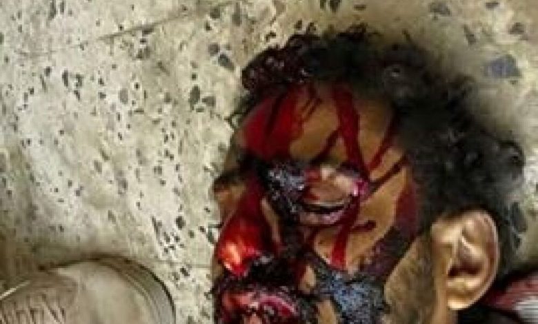 سقوط 6 شهداء بينهم امرأة برصاص قناصة ميليشيات الحوثي واصابة 25 أخرين بالضالع